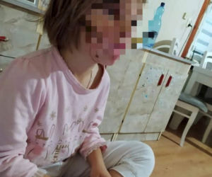 Obrazek przedstawiający rany na skórze Julki